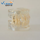 Natural Size Dental Study Models VIC-B2  24pcs Plastic Orthodontic Teeth Model